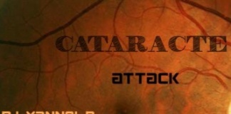 DJ YANNEL.R – CATARACTE ATTACK